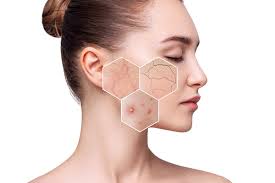 Sensitive Skin - KOREAN SKINCARE PAKISTAN