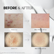 VT COSMETICS VT Reedle Shot 300 | Advanced Micro - Needle Serum for Deep Skin Repair in Pakistan - VT COSMETICS