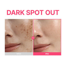 Before and after comparison of dark spots on skin with 'DARK SPOT OUT' text.