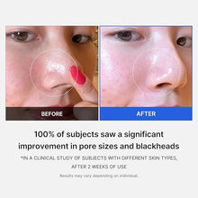 [A] Open Pores and Blackheads Treatment Kit - Korean Skincare.PK