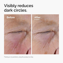 The Ordinary Caffeine Solution 5% + EGCG – Serum For Under Eye Puffiness, Dark Circles and Tired Eyes | 100% Authentic products in Pakistan