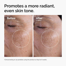 The Ordinary Glycolic Acid 7% Exfoliating Toner – Glow-Boosting AHA Toner | 100% Authentic products in Pakistan