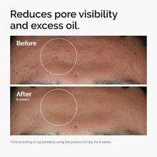 The Ordinary Niacinamide 10% + Zinc 1% Serum – Oil Control & Pore Minimizer – 100% Original in Pakistan