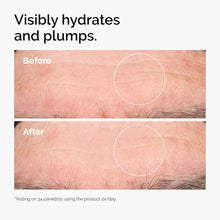 The Ordinary Hyaluronic Acid 2% + B5 + Ceramides Serum – Deep Hydration & Skin Barrier Repair – 100% Original in Pakistan