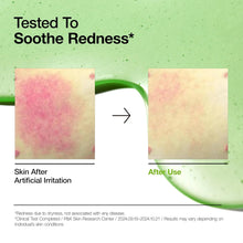 [ANUA] - Azelaic Acid 10 Redness Soothing Serum 30ml – Authentic Korean Skincare in Pakistan - ANUA