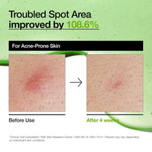 [ANUA] - Azelaic Acid 10 Redness Soothing Serum 30ml – Authentic Korean Skincare in Pakistan - ANUA