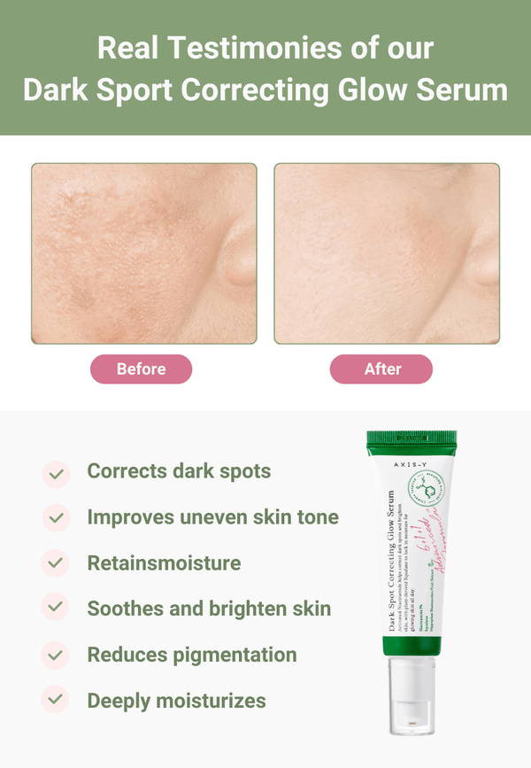 Dark Spots Defense Kit – COSRX Snail 96 Essence + AXIS - Y Dark Spot Correcting Serum for Glowing Skin - KOREAN - SKINCARE.PK