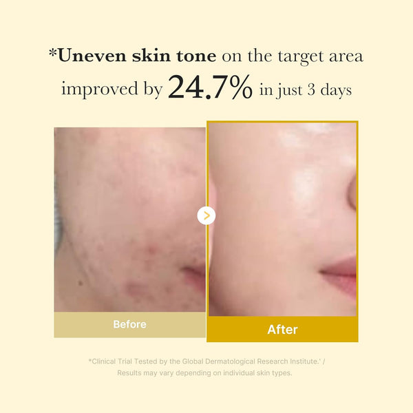 Medicube Kojic Acid Turmeric Night Wrapping Mask – 75ml - Authentic Korean Skincare in pakistan - Medicube