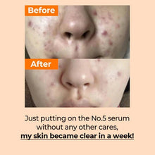 [Numbuzin] No.5 Goodbye Blemish Serum 50ml – Dark Spot Correcting & Brightening Serum – Authentic Korean Skincare in Pakistan - numbuzin