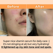 [Numbuzin] No.5 Goodbye Blemish Serum 50ml – Dark Spot Correcting & Brightening Serum – Authentic Korean Skincare in Pakistan - numbuzin