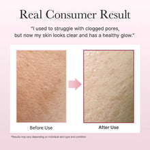 Arencia Fresh Rosehip Rice Mochi Cleanser Results Before and after skin comparison showing clogged pores reduction with text on a pink background.