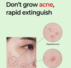 [SOME BY MI] Miracle AC Clear Spot Treatment 10g – Acne Spot Gel for Breakouts | Authentic Korean skincare Pakistan - SOME BY MI