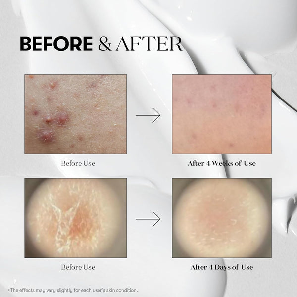 VT COSMETICS VT Reedle Shot 300 | Advanced Micro - Needle Serum for Deep Skin Repair in Pakistan - VT COSMETICS